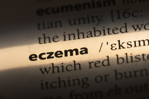 Top 5 Causes of Eczema!
