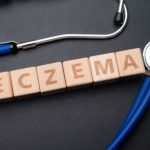 5 Tips for Eczema!