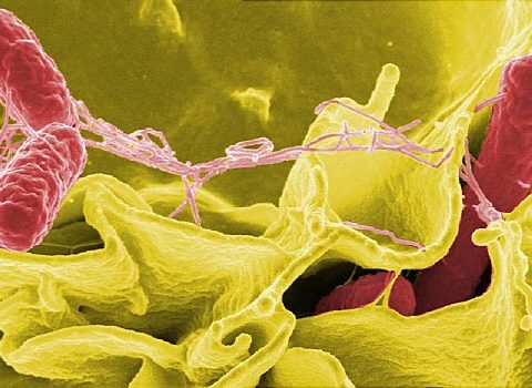 The Deadly Salmonella Outbreak In The US