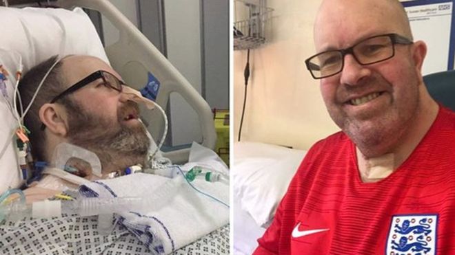 Man Who Nearly Died From Flu Speaks Out