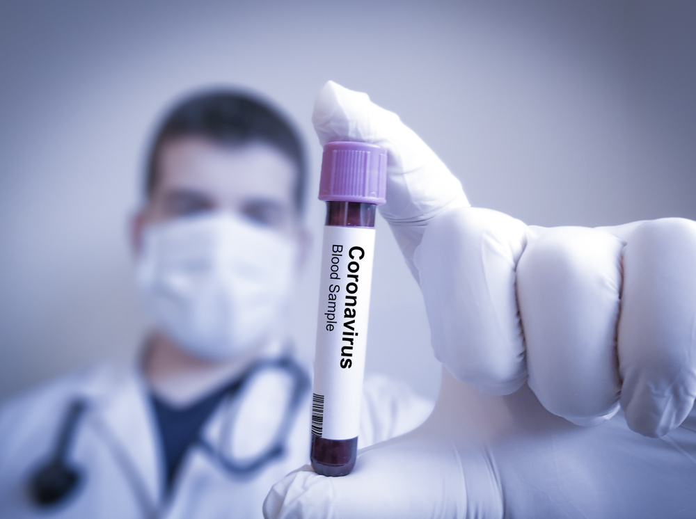 Coronavirus Tests “Promised” in Care Homes!