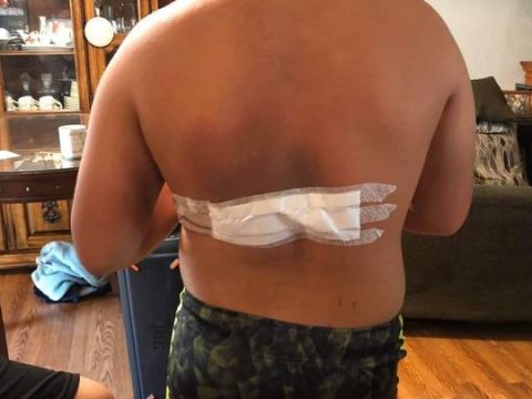 Teens Charger Pack Explodes In The Night