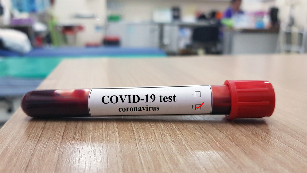 UK Covid-19 Update!