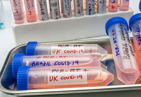 Is This the End for Covid-19 in the UK?