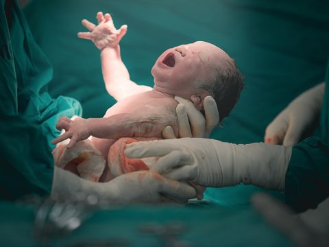 NHS England drops limit on offering Caesarean births!