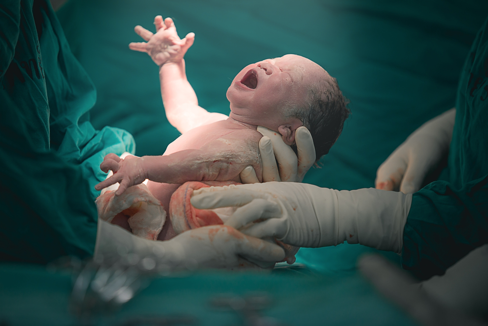 NHS England drops limit on offering Caesarean births!